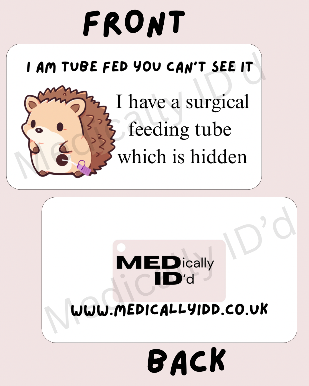 I Am Tube Fed You Can’t See It