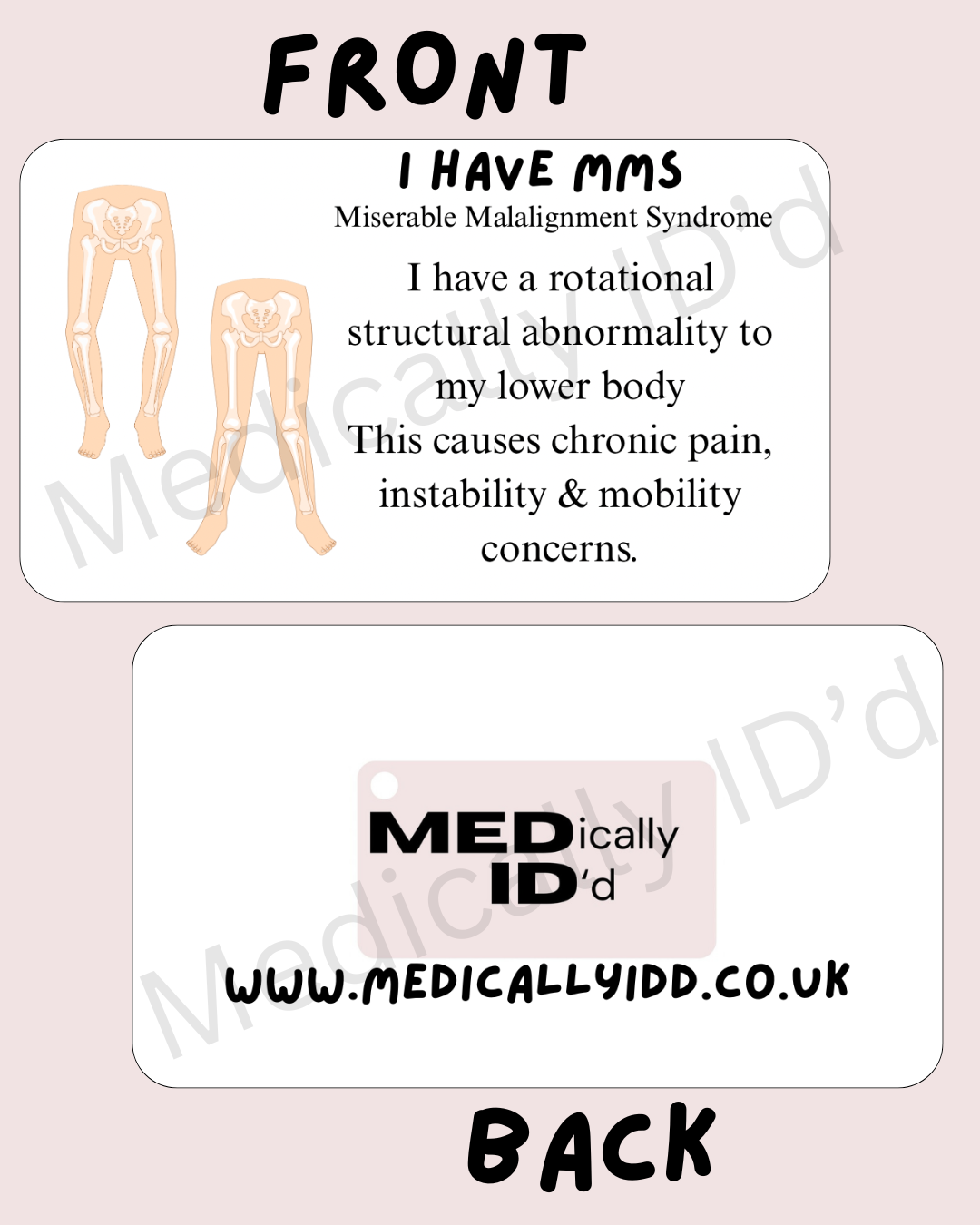I have MMS (Miserable Malalignment Syndrome)