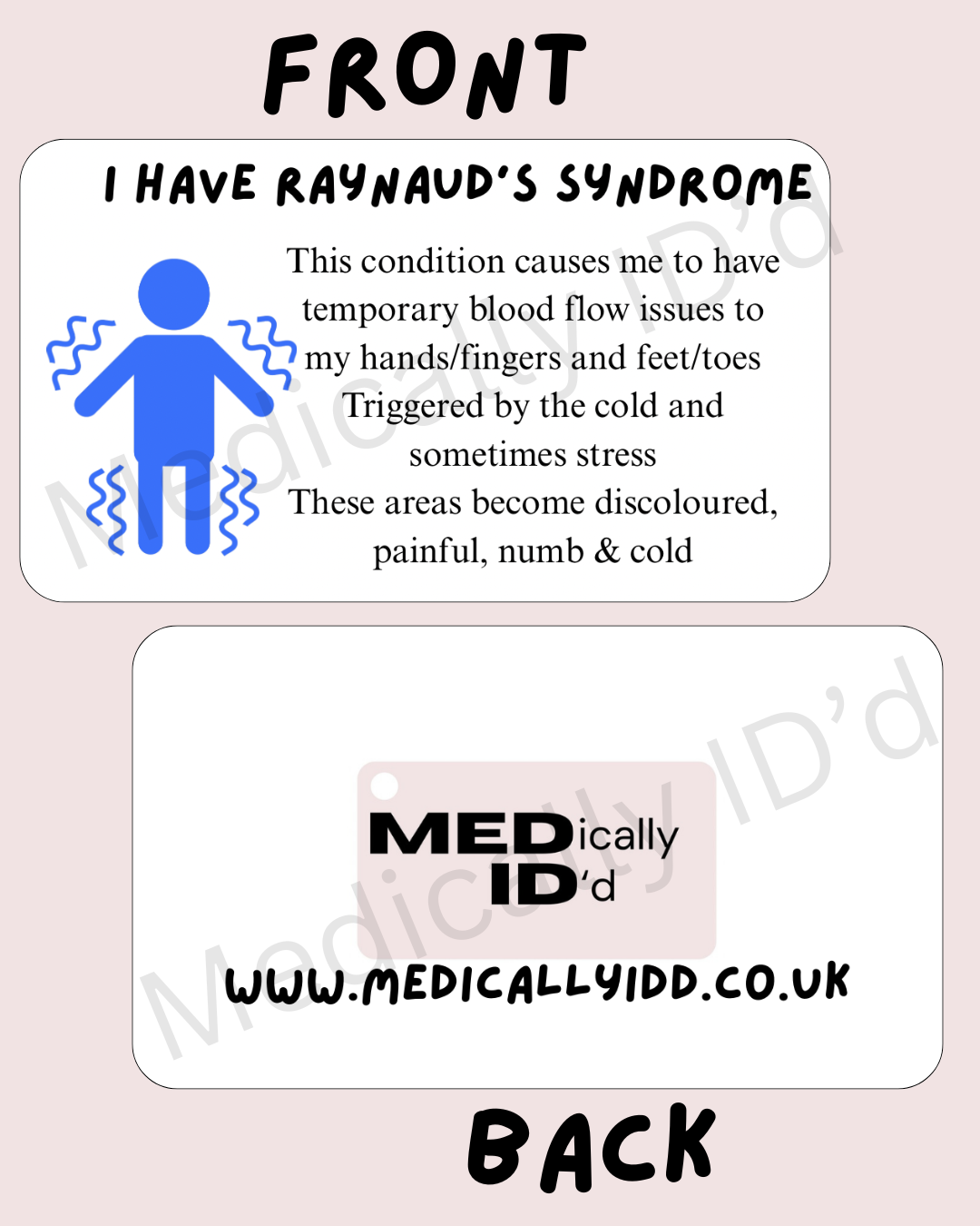 I have Raynaud’s Syndrome